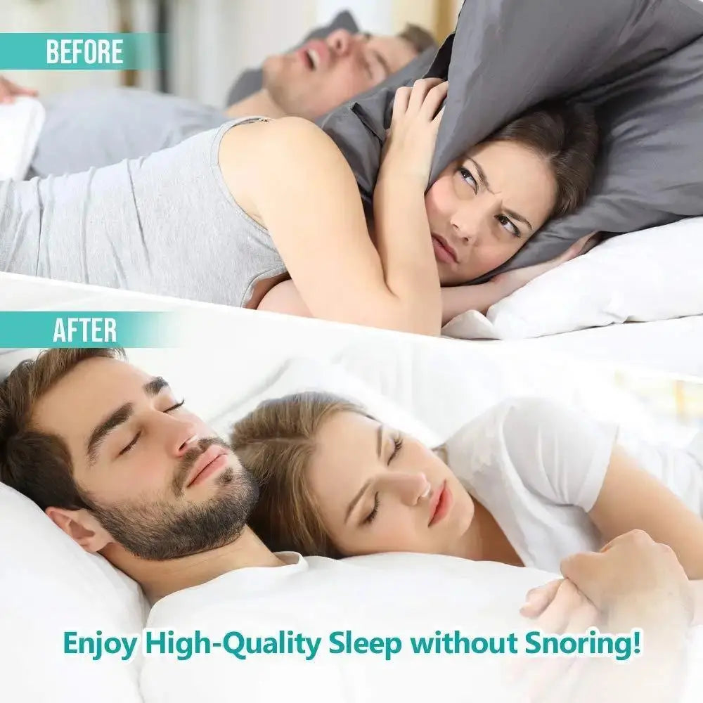 Anti-Snoring Corrector Snore Prevention Gadget Women's Anti-Snore Device Snore Elimination Nose Clip Men's Sleep Night TMSmartHub2021