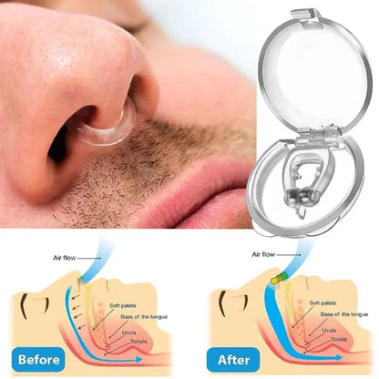 Anti-Snoring Corrector Snore Prevention Gadget Women's Anti-Snore Device Snore Elimination Nose Clip Men's Sleep Night TMSmartHub2021